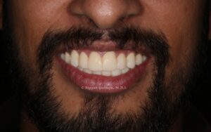 After