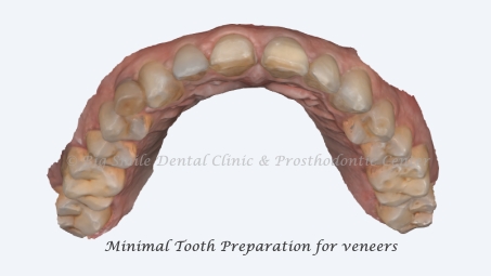 broken-front-tooth-fix-before-after.jpg